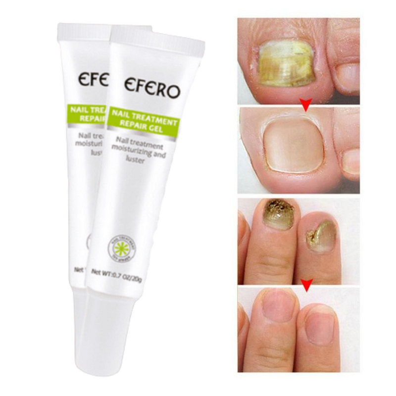 Creme para Unhas - Efero